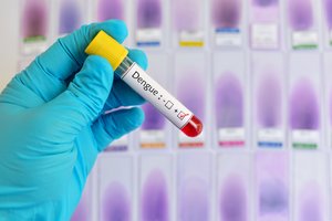 Mirtinai pavojinga karštligė paskelbta nacionalinio masto epidemija