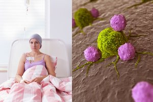 Tyrimas parodė, kas tikimybę susirgti vėžiu didina kone taip pat, kaip rūkymas