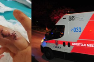 Pirštus susipjausčiusi kaunietė išplūdo ligoninę: „Ranka buvo kraujo klane“