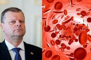 Vėžys, kuriuo serga premjeras, klastingas – simptomus galite praleisti nemačiomis