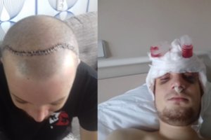 Palangoje siaubingai sužalotas vaikinas padavė ligoninę į teismą: dar kiek ir aš – daržovė