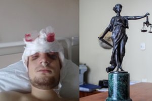 Teisininkas įvardijo, kas blogiausio laukia didžiules traumas pražiopsojusių gydytojų