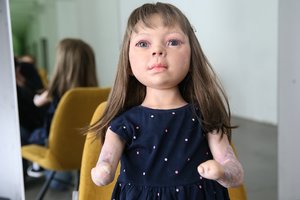 Klastinga infekcija smogia Lietuvoje smarkiau nei kitur: štai į ką atkreipti dėmesį