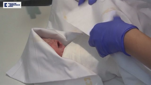 Medikai skelbia atlikę unikalią gimdymo operaciją – iš karto po to leido motinai numirti