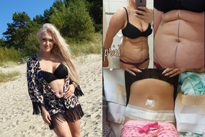 Žvaigždžių stilistė Reveka Devolskytė paviešino plastinių operacijų rezultatus: „Esu laimingiausia moteris“