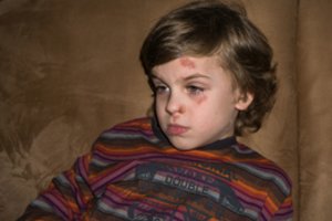 Mamos pagalbos šauksmas: mokytoja grasino, kad atims vaiką, kurį muša bendraklasis