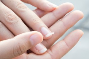 Išblyškusi oda ir lūžinėjantys nagai gali signalizuoti rimtą ligą