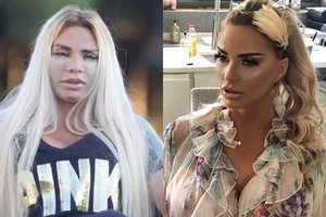 Turkijos operacinėje išvaizdą vėl keitusi Katie Price gerbėjus gąsdino sutvarstytu veidu