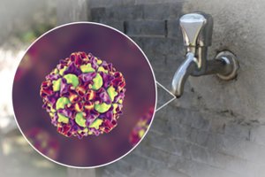 Po 19 metų – naujas lengvai užkrečiamos ir potencialiai mirtinos ligos protrūkis