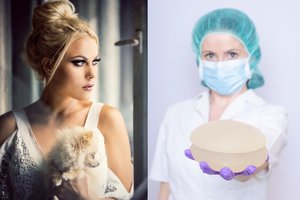 N. Pareigytei plyšo krūties implantas: chirurgas paaiškino, kodėl taip nutinka ir kas gresia