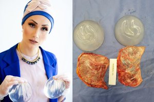 Noras būti gražesnei Simonai tapo prakeiksmu: įspėja ir kitas