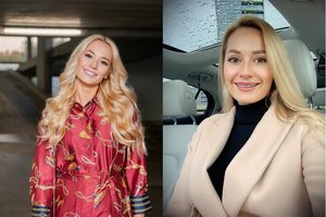 „Mis Lietuva 2013“ Rūta Elžbieta Mazurevičiūtė dantis pakaustė kabėmis ir gavo pravardę