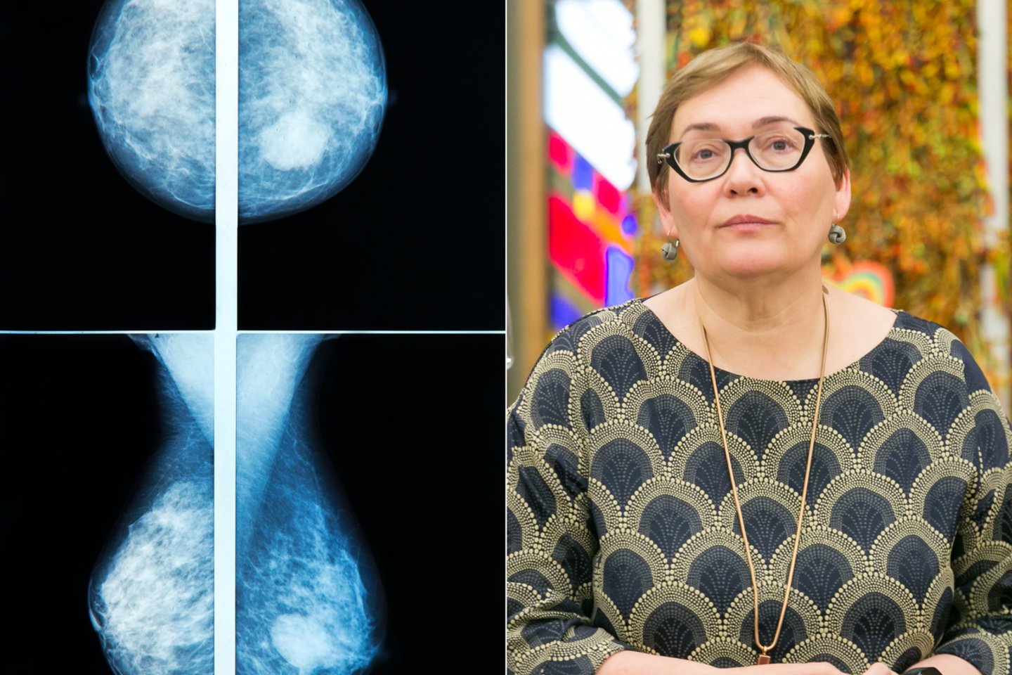 Skelbiama, kad A.Maldeikienei nustatytas antrosios stadijos krūties vėžys. <br> 123rf ir T.Bautro nuotr.