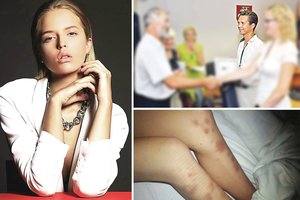 Manekenės D. Didžiūnaitytės išžaginimu įtariamas chirurgas A. Miltenis turi daugiau bėdų