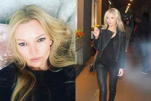 Kate Moss antrininkė vos išgyveno avariją: dėl randų pasirinko atsiskyrėlės dalią