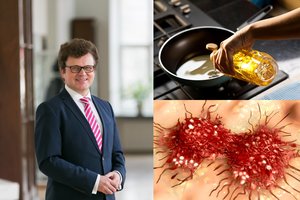 Profesorius R. Stukas įspėjo, kokie maisto produktai didina vėžio riziką 