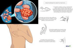 Svarbu kiekvienai moteriai: kaip atlikti krūtų savityrą ir laiku atpažinti vėžį