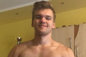 Krūvą pinigų aknės gydymui išleidęs šiaulietis rado netikėtą būdą, kaip pasveikti