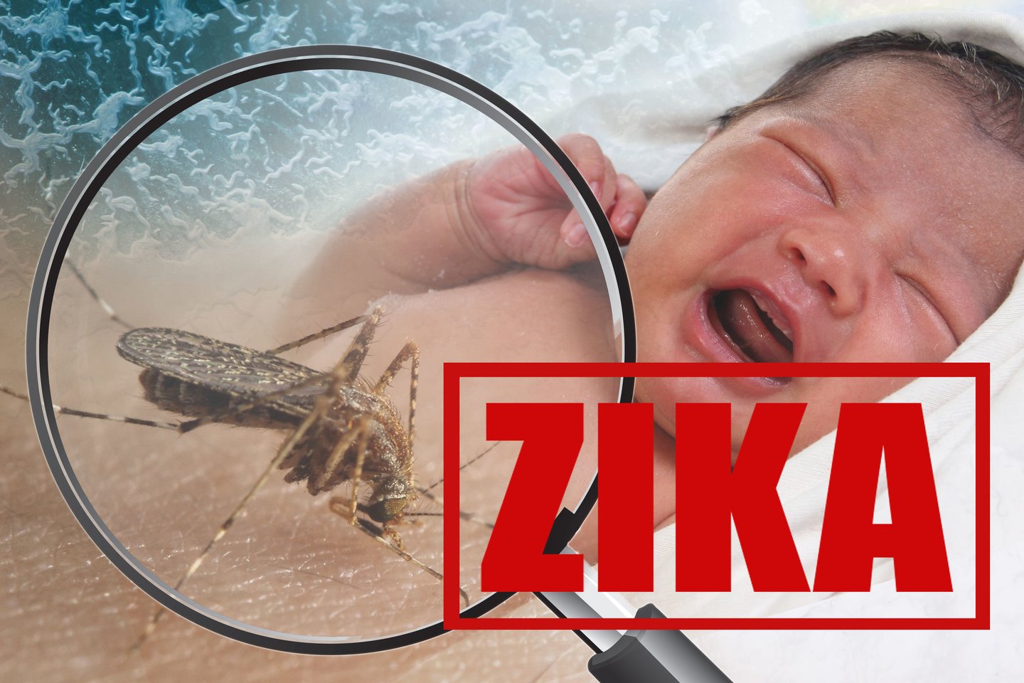 Zikos virusas gali būti susijęs su Guillain-Barre sindromo išsivystymu ar būti naujagimių mikrocefalijųir kitų įgimtų centrinės nervų sistemos pažeidimų priežastis.<br> 123rf nuotr.