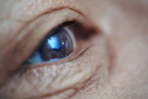 Širdies ligą išdavė keistai atrodantys vyro akių vyzdžiai