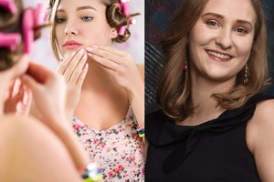 Dermatovenerologė išvardijo 6 klaidas, kurias daro sergantieji akne