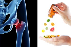 Nedarykite dažnos klaidos: perdėtas šio vitamino vartojimas lemia rimtas bėdas