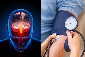 Nustatė, kaip gydyti aukštą kraujospūdį, kad mažiau būtų pažeistos smegenys