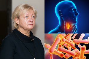 Medikai sunerimę: prie Lietuvos – mirtinos ir sunkiai suvaldomos ligos protrūkis