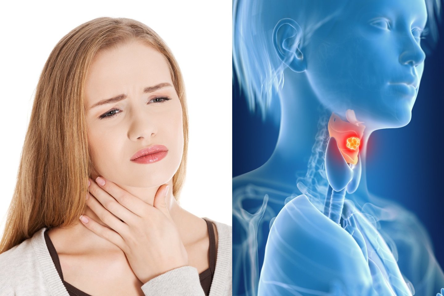 Prikimęs balsas gali būti ir balso stygų vėžio simptomas.<br>123rf nuotr.