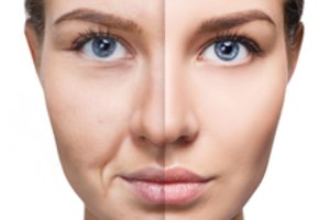 Veide plika akimi matomi požymiai, jog vartojate per daug alkoholio