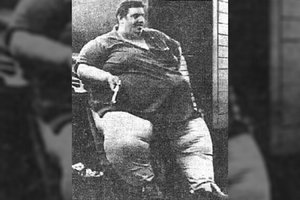 Sunkiausio pasaulyje žmogaus istorija: kaip jo kūne atsirado daugiau nei 400 kg vandens?