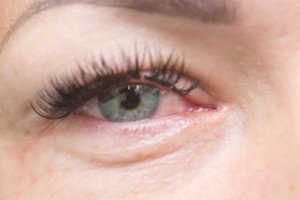 68-erių moteriai pradėjo dirginti dešinę akį: priežastis – lyg iš siaubo filmo