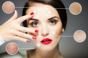 Sausą ir šerpėjančią oda pamiršite: pravers keli paprasti patarimai