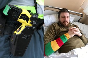 Žinomas vilnietis teigia patyręs žiaurų policijos elgesį: „Net 17 kartų kratė elektrošoku“