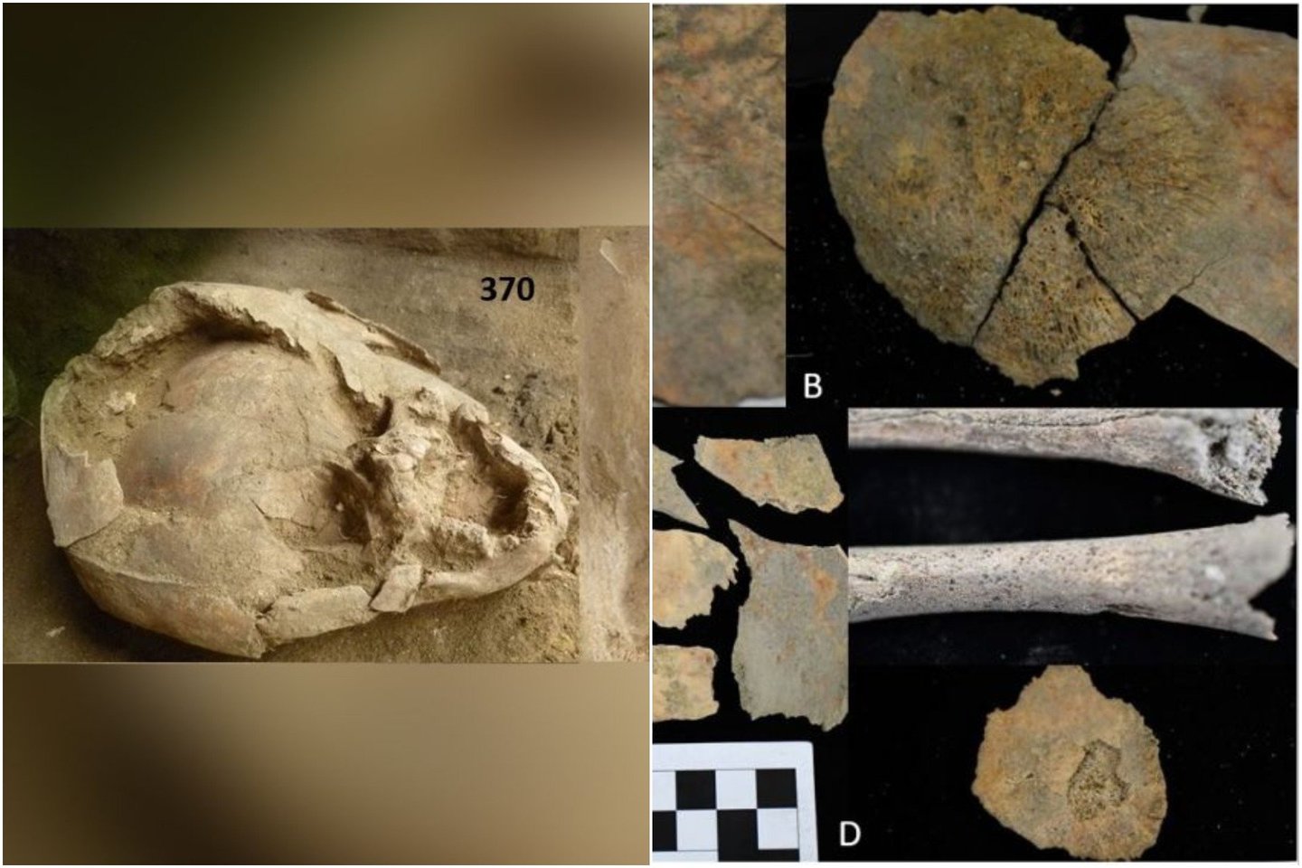  Prieš 2100 metų du kūdikiai buvo palaidoti dėvintys „šalmus“, pagamintus iš kitų vaikų kaukolių, teigia archeologai.<br>  Sara'os Juengst nuotr.