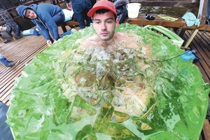 Ilgai kamavusios žvynelinės vilnietis Artūras atsikratė netikėtai: nereikėjo nė vaistų