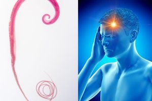 47 metų vyro galvoje įsiveisė parazitai: priežastis slypėjo maiste