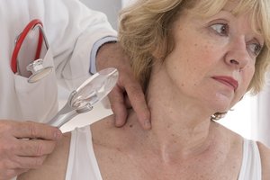 Mokslininkai aptiko vitaminą, kuris gali padėti gydyti odos vėžį