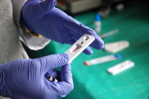 Šiemet ŽIV testų vaistinėse parduota dvigubai daugiau nei pernai