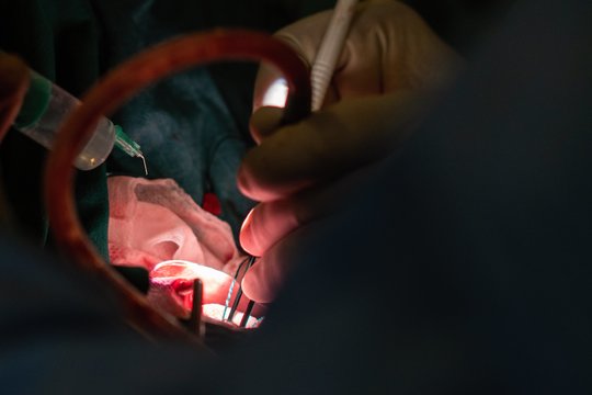 Pirmą kartą Lietuvoje atlikta operacija išgelbėjo penkiametės Orijanos gyvybę