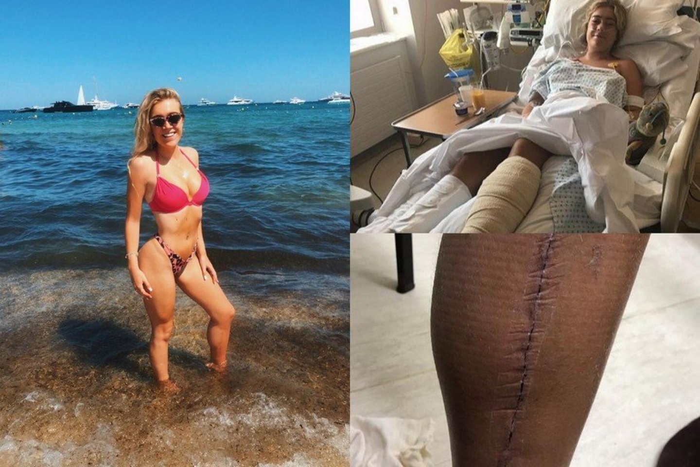  Tai, kad merginos koja buvo išgelbėta ir ji išgyveno, gydytojai vadina stebuklu.<br> Instagramo nuotr.