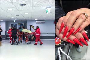 Prieš šventes medikai stiprina pajėgas: kreipiasi net dėl lūžusio priauginto nago