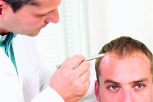 Plaukų persodinimą Turkijos medikams patikėjęs lietuvis neatsidžiaugia savo sprendimu