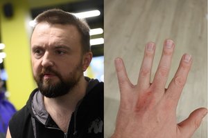 Stanislavas Stavickis-Stano per plauką išvengė tragedijos: vos spėjo apsaugoti ir vaikus