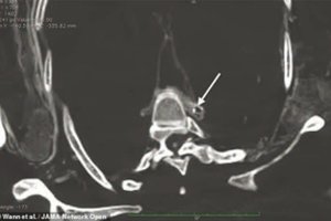Arktyje rastos mumijos sirgo liga, kuri labai pavojinga ir šiandien