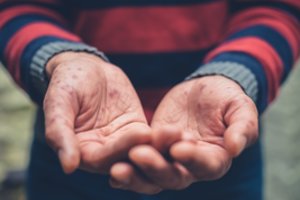 Kaune užregistruotas pirmasis šiemet tymų atvejis