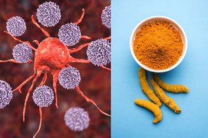 67-erių metų moteris teigė išsigydžiusi vėžį, kasdien valgydama vieną prieskonį