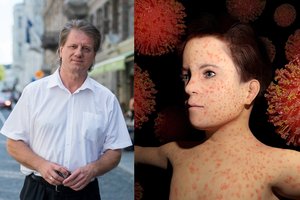 Profesorius Saulius Čaplinskas apie tymus: čia lazda su dviem galais