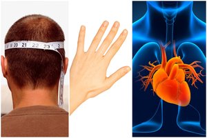 Riziką susirgti tam tikromis ligomis lemia ūgis ir net pirštų ilgis: į ką atkreipti dėmesį?