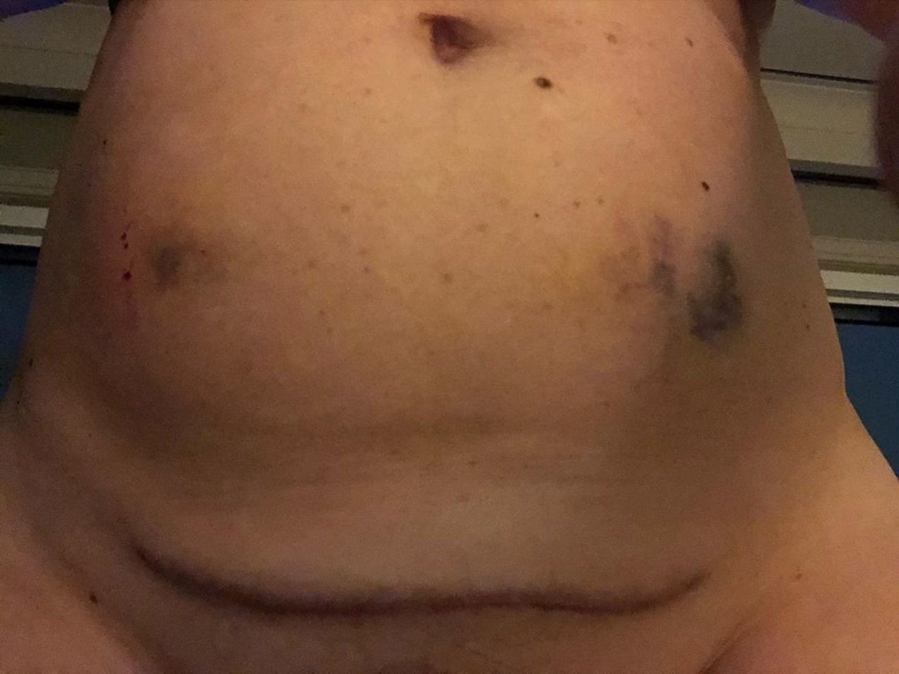  Amy Schumer prašo patarimo.<br> Instagramo nuotr.